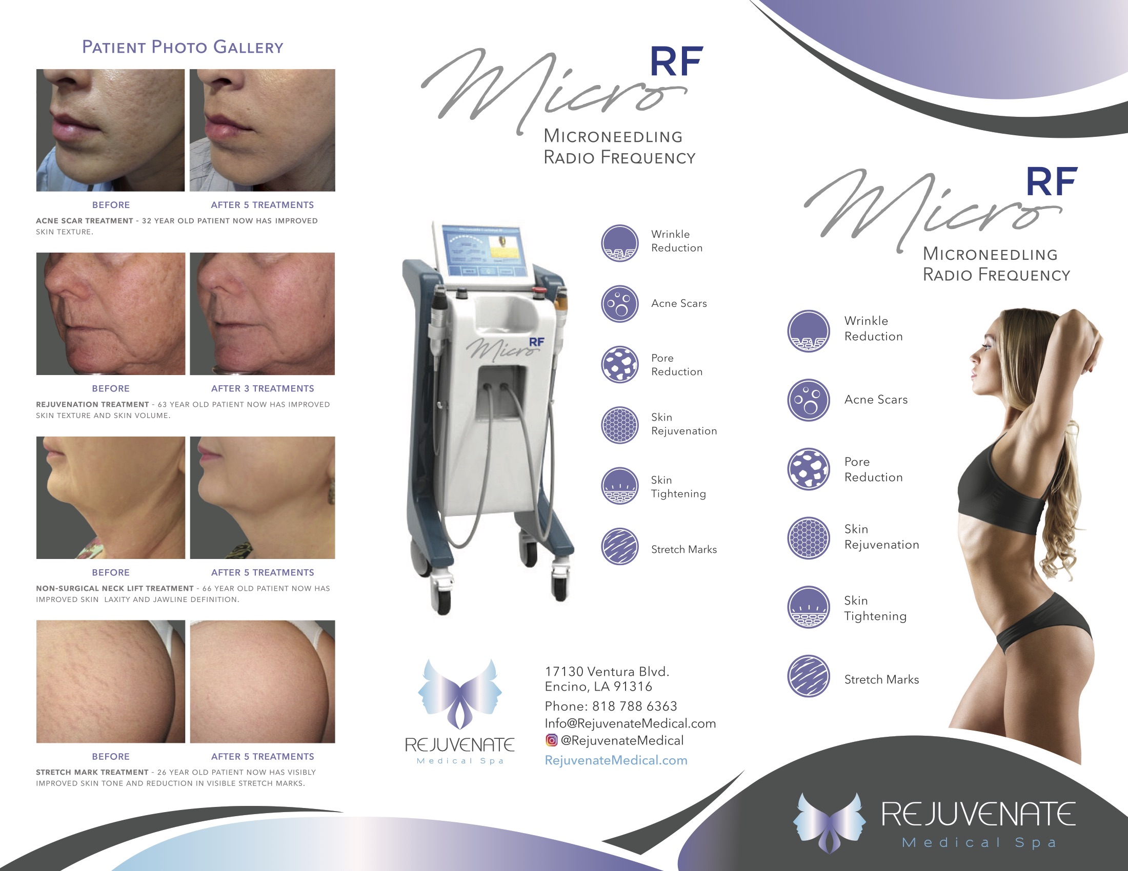 UltraShape - Los Angeles California Medical Spa