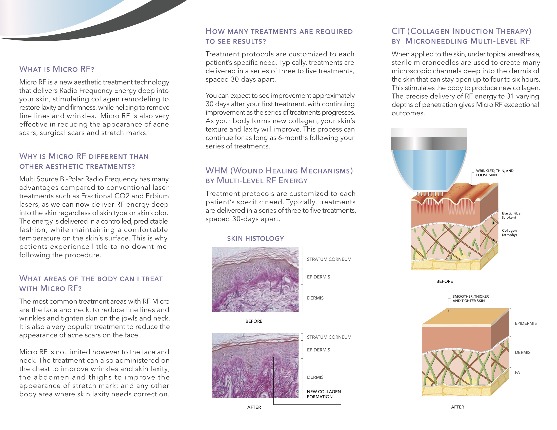 Radio-frequency (RF) Technology for Aesthetic Treatments