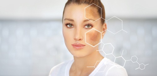 Rosacea Treatment Los Angeles Encino Sherman Oaks Tazana